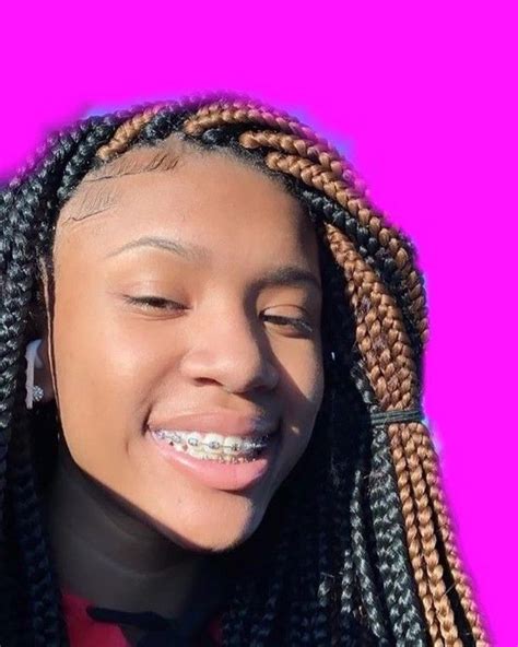 laila braces girl|laifacebrace hair.